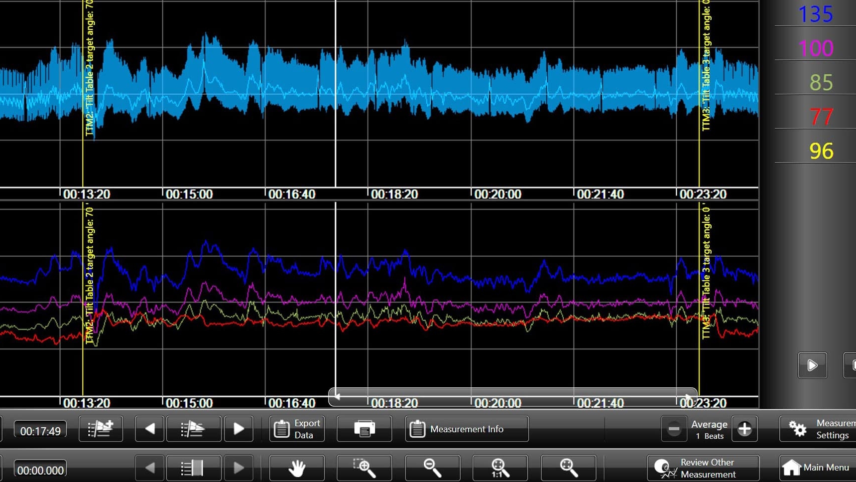 Data processing and printing compressed