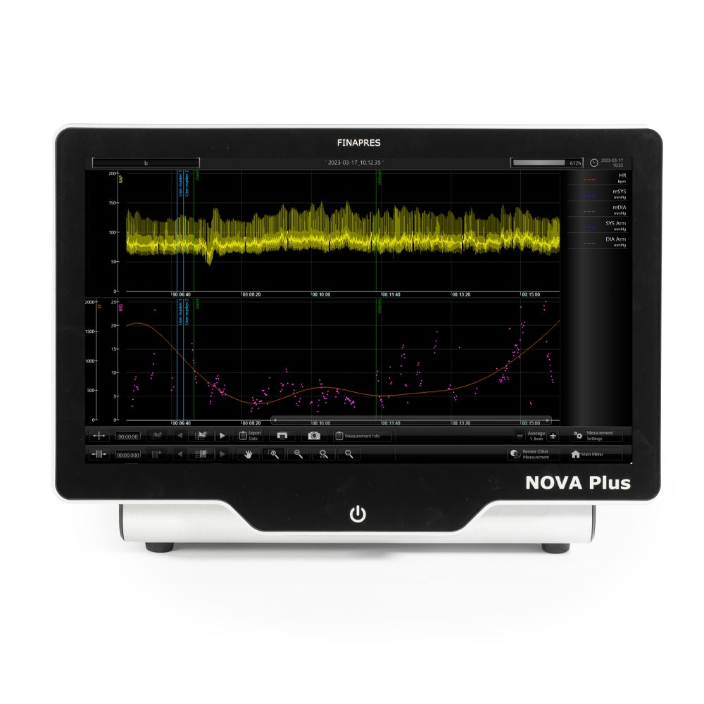 Baroreceptor sensitivity