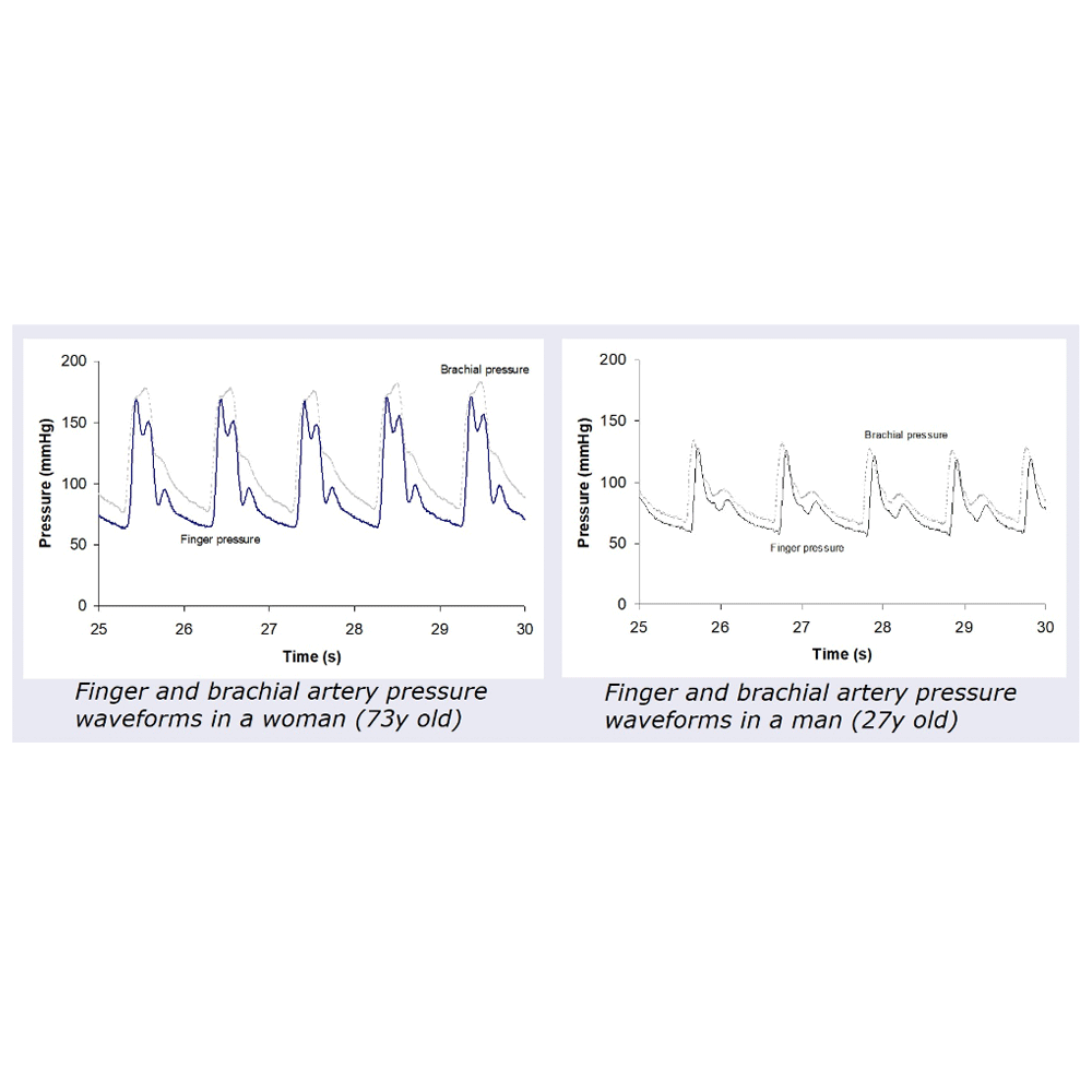 These graphs, obtained from [5], show finger and brachial pressure waveforms from a woman (73y old) and a man (27y old).